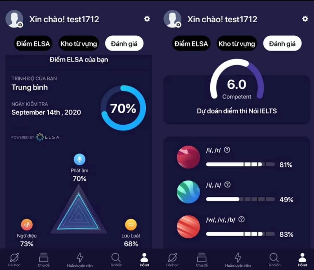 So sánh bản Elsa pro và free